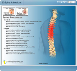 Click here to see 3D animations to better understand your condition and treatment.